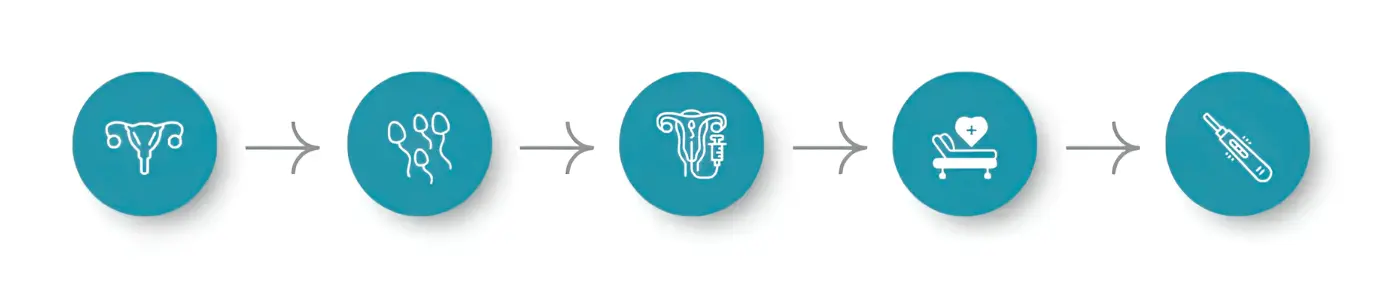 Our IUI Treatment Process